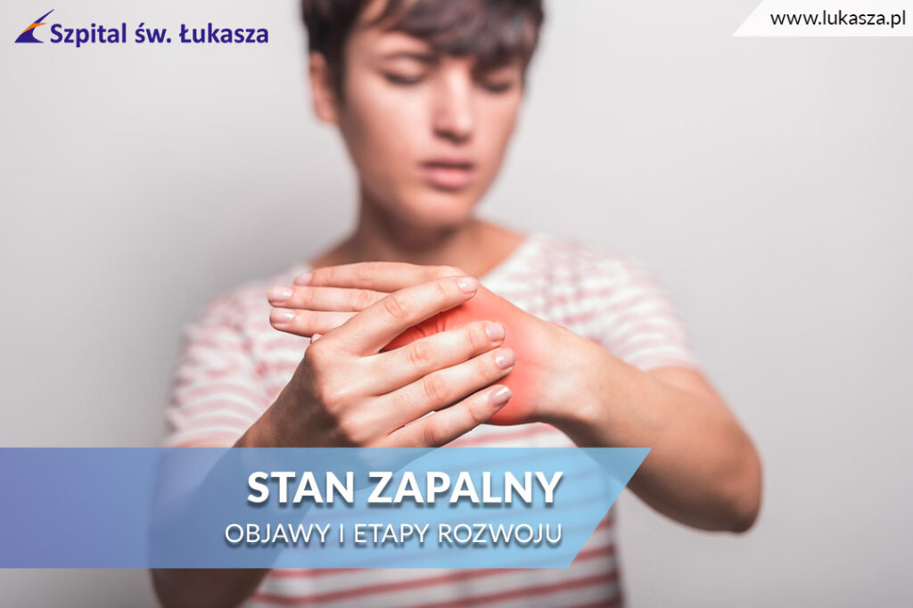 Stan zapalny - objawy i etapy rozwoju
